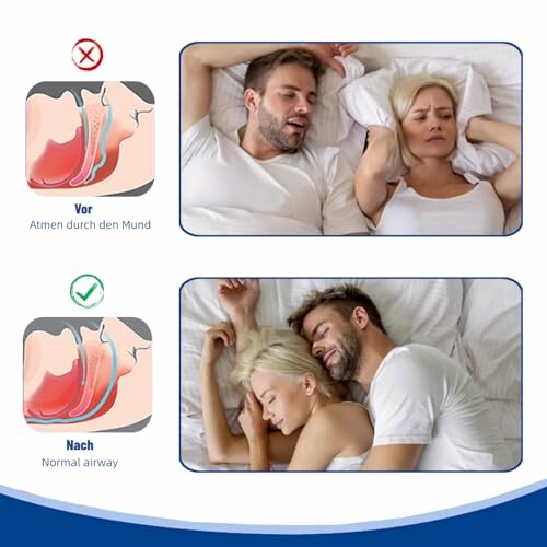 Nasenpflaster Schnarchstopper